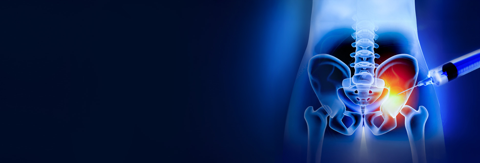 MEDICINA RIGENERATIVA E TRATTAMENTI PERCUTANEI